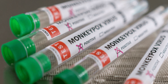 Rio de Janeiro confirma quinto caso de varíola dos macacos